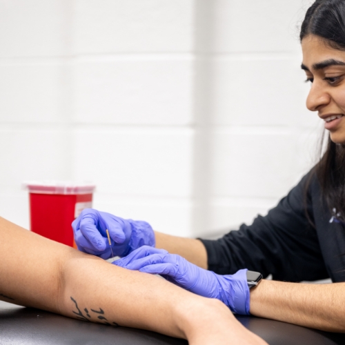 dry-needling-Apex-Performance-Therapy-North-Bethesda-MD