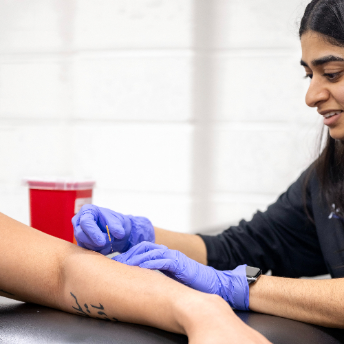homepage-dry-needling-apex-performance-therapy-north-bethesda-md